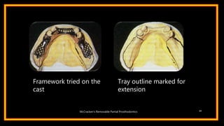Framework tried on the
cast
Tray outline marked for
extension
64McCracken’s Removable Partial Prosthodontics
 