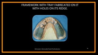 FRAMEWORK WITH TRAY FABRICATED ON IT
WITH HOLES ON ITS RIDGE.
65
McCracken’s Removable Partial Prosthodontics
 