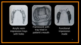 Acrylic resin
impression trays
with holes
Framework with
tray tried in
patient’s mouth
Functional
impression
made
67
 
