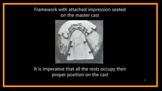 Framework with attached impression seated
on the master cast
It is imperative that all the rests occupy their
proper position on the cast
74
 