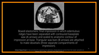 78
Boxed elastomeric final impression in which edentulous
ridges have been separated with contoured baseplate
wax (A arrows) and sealed to anatomic contour of
impression at base. Triangular wax bars (B arrows) are attached
to make dovetails (three separate compartments of
impression).
Izharul Haque Ansari: A new procedure for separating the edentulous distal extension portion from the master cast when an
altered cast is made. J Prosthet Dent 1994;72:666-9.
 