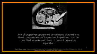 79
Mix of properly proportioned dental stone vibrated into
three compartments of impression. Impression must be
overfilled to make solid base to prevent premature
separation
Izharul Haque Ansari: A new procedure for separating the edentulous distal extension portion from the master cast when an
altered cast is made. J Prosthet Dent 1994;72:666-9.
 