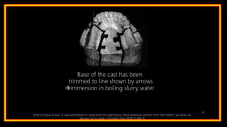 81
Base of the cast has been
trimmed to line shown by arrows
immersion in boiling slurry water.
Izharul Haque Ansari: A new procedure for separating the edentulous distal extension portion from the master cast when an
altered cast is made. J Prosthet Dent 1994;72:666-9.
 