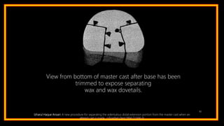 82
View from bottom of master cast after base has been
trimmed to expose separating
wax and wax dovetails.
Izharul Haque Ansari: A new procedure for separating the edentulous distal extension portion from the master cast when an
altered cast is made. J Prosthet Dent 1994;72:666-9.
 