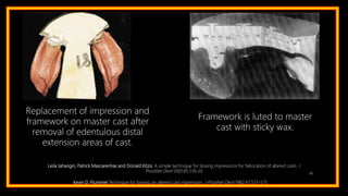 85
Replacement of impression and
framework on master cast after
removal of edentulous distal
extension areas of cast.
Framework is luted to master
cast with sticky wax.
Leila Jahangiri, Patrick Mascarenhas and Donald Kitzis: A simple technique for boxing impressions for fabrication of altered casts. J
Prosthet Dent 2001;85:519-20
Kevin D. Plummer:Technique for boxing an altered cast impression. J Prosthet Dent 1982;47:573-575
 
