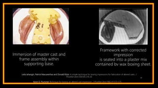 87
Immersion of master cast and
frame assembly within
supporting base.
Framework with corrected
impression
is seated into a plaster mix
contained bv wax boxing sheet.
Leila Jahangiri, Patrick Mascarenhas and Donald Kitzis: A simple technique for boxing impressions for fabrication of altered casts. J
Prosthet Dent 2001;85:519-20
Kevin D. Plummer:Technique for boxing an altered cast impression. J Prosthet Dent 1982;47:573-575
 
