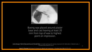 91
Boxing wax placed around plaster
base and cast leaving at least 20
mm from top of wax to highest
point on impression.
Leila Jahangiri, Patrick Mascarenhas and Donald Kitzis: A simple technique for boxing impressions for fabrication of altered casts. J
Prosthet Dent 2001;85:519-20
Kevin D. Plummer:Technique for boxing an altered cast impression. J Prosthet Dent 1982;47:573-575
 