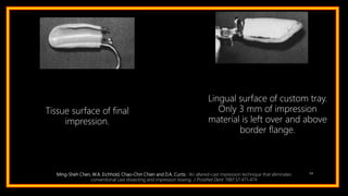 94Ming-Sheh Chen, W.A. Eichhold, Chao-Chin Chien and D.A. Curtis : An altered-cast impression technique that eliminates
conventional cast dissecting and impression boxing. J Prosthet Dent 1987;57:471-474
Tissue surface of final
impression.
Lingual surface of custom tray.
Only 3 mm of impression
material is left over and above
border flange.
 