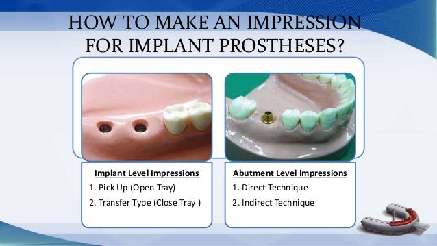 implant impression Impression techniques implant impression Impression techniques