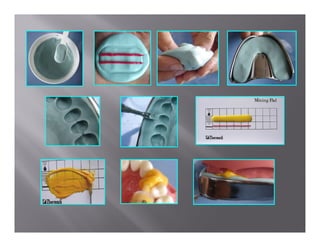 Impression techniques | PDF
