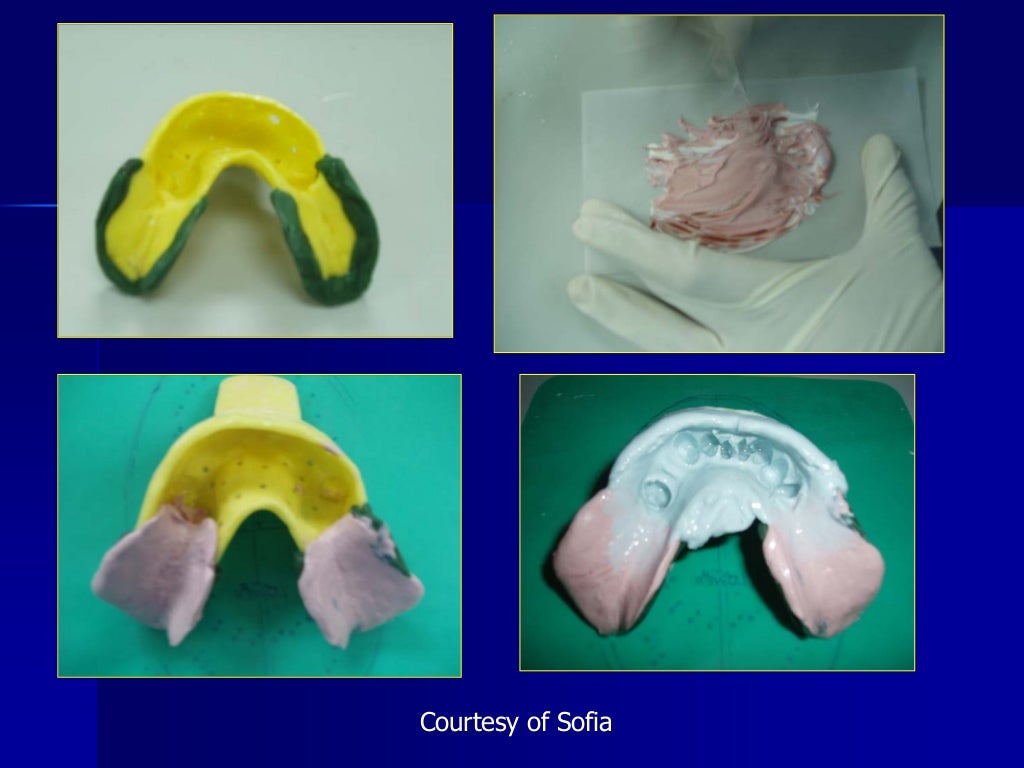 Impression techniques and materials partial dentures yr 3