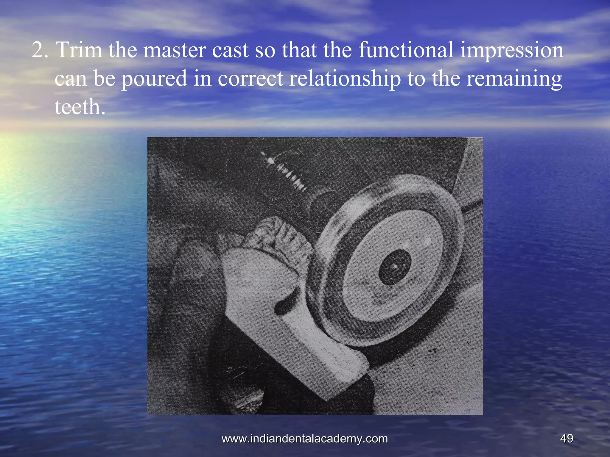 4949
2. Trim the master cast so that the functional impression
can be poured in correct relationship to the remaining
teeth.
www.indiandentalacademy.comwww.indiandentalacademy.com
 