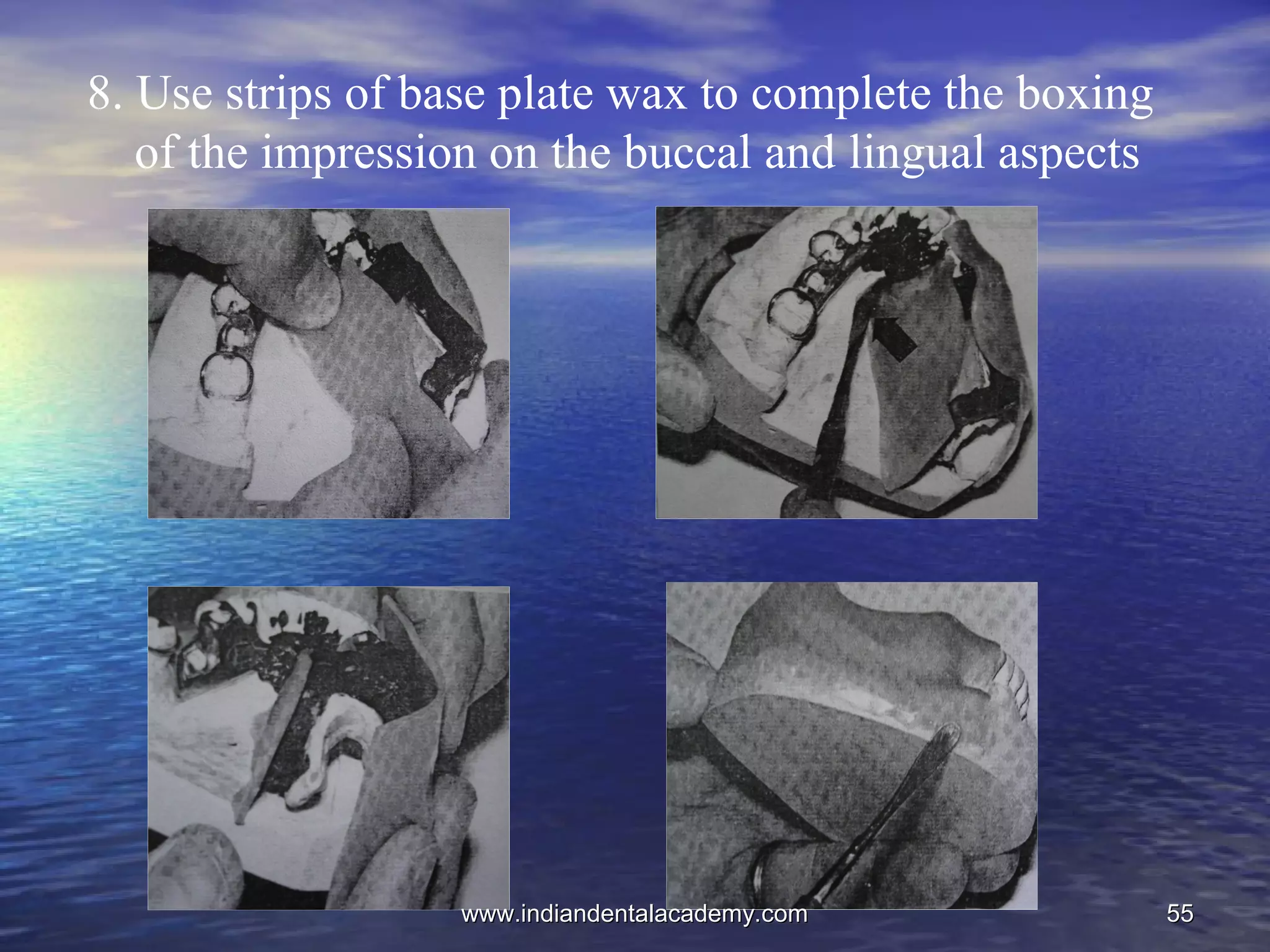 5555
8. Use strips of base plate wax to complete the boxing
of the impression on the buccal and lingual aspects
www.indiandentalacademy.comwww.indiandentalacademy.com
 