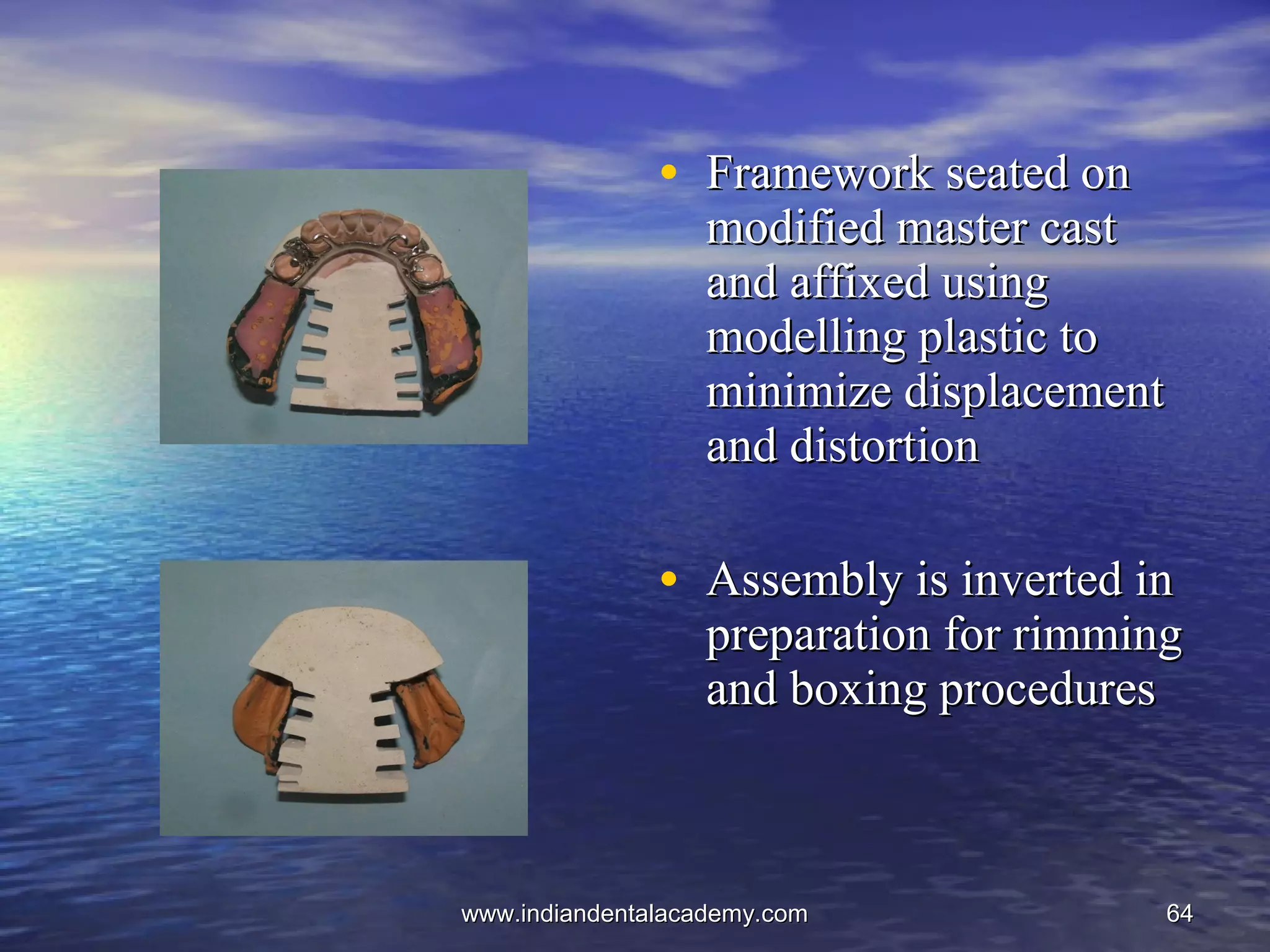 6464
• Framework seated onFramework seated on
modified master castmodified master cast
and affixed usingand affixed using
modelling plastic tomodelling plastic to
minimize displacementminimize displacement
and distortionand distortion
• Assembly is inverted inAssembly is inverted in
preparation for rimmingpreparation for rimming
and boxing proceduresand boxing procedures
www.indiandentalacademy.comwww.indiandentalacademy.com
 