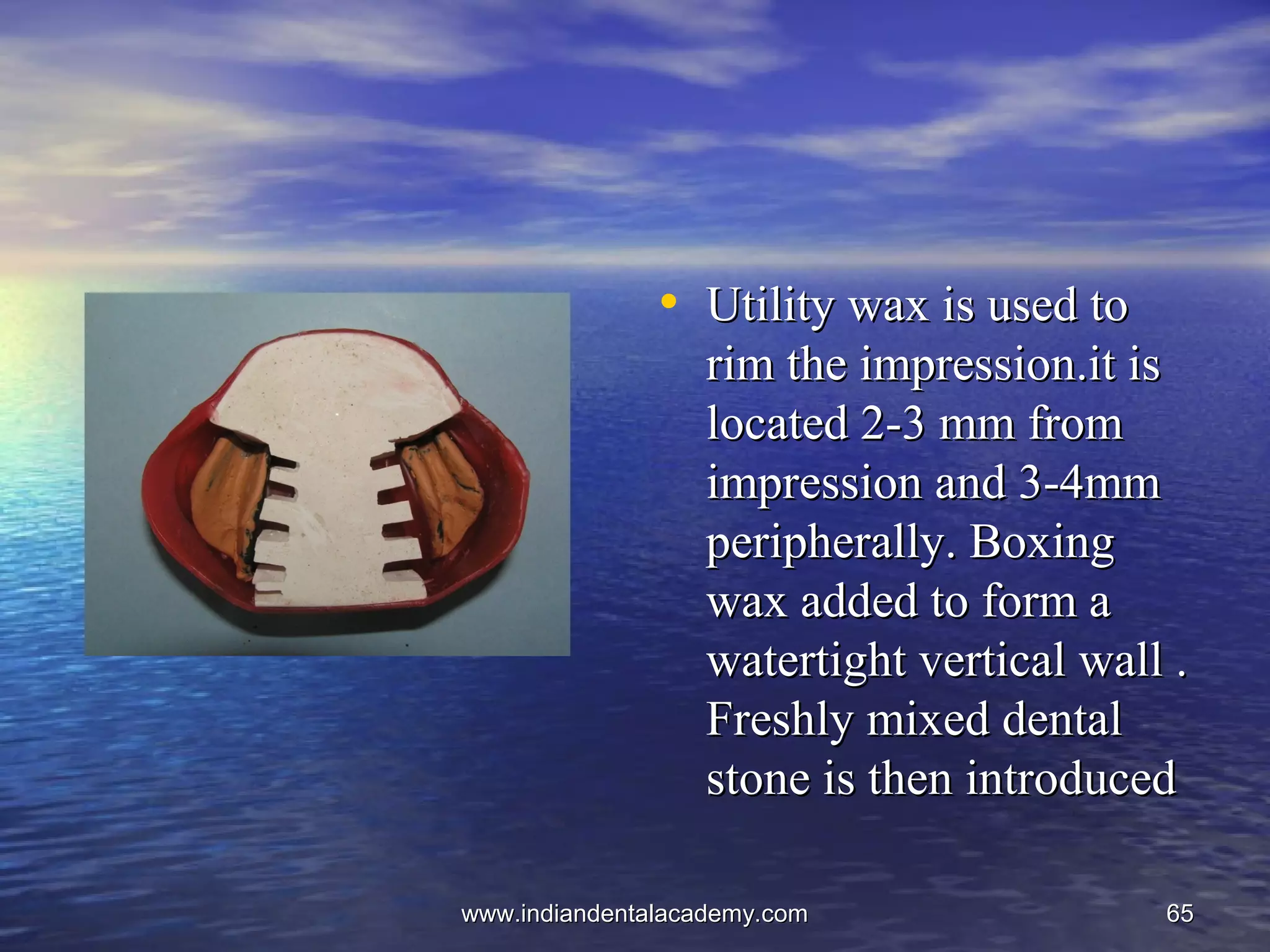 6565
• Utility wax is used toUtility wax is used to
rim the impression.it isrim the impression.it is
located 2-3 mm fromlocated 2-3 mm from
impression and 3-4mmimpression and 3-4mm
peripherally. Boxingperipherally. Boxing
wax added to form awax added to form a
watertight vertical wall .watertight vertical wall .
Freshly mixed dentalFreshly mixed dental
stone is then introducedstone is then introduced
www.indiandentalacademy.comwww.indiandentalacademy.com
 