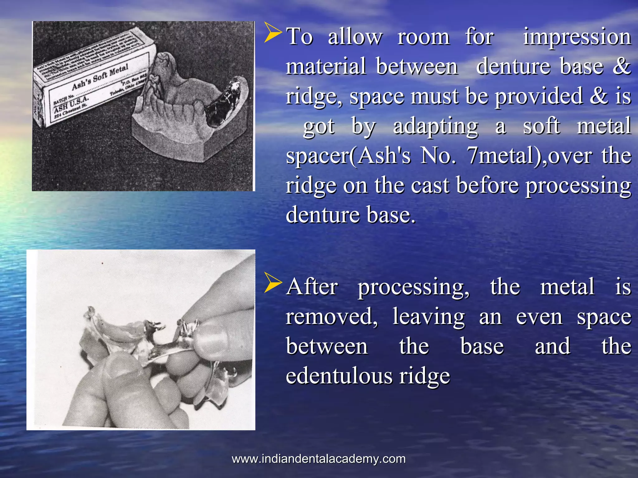 To allow room for impressionTo allow room for impression
material between denture base &material between denture base &
ridge, space must be provided & isridge, space must be provided & is
got by adapting a soft metalgot by adapting a soft metal
spacer(Ash's No. 7metal),over thespacer(Ash's No. 7metal),over the
ridge on the cast before processingridge on the cast before processing
denture base.denture base.
After processing, the metal isAfter processing, the metal is
removed, leaving an even spaceremoved, leaving an even space
between the base and thebetween the base and the
edentulous ridgeedentulous ridge
www.indiandentalacademy.comwww.indiandentalacademy.com
 