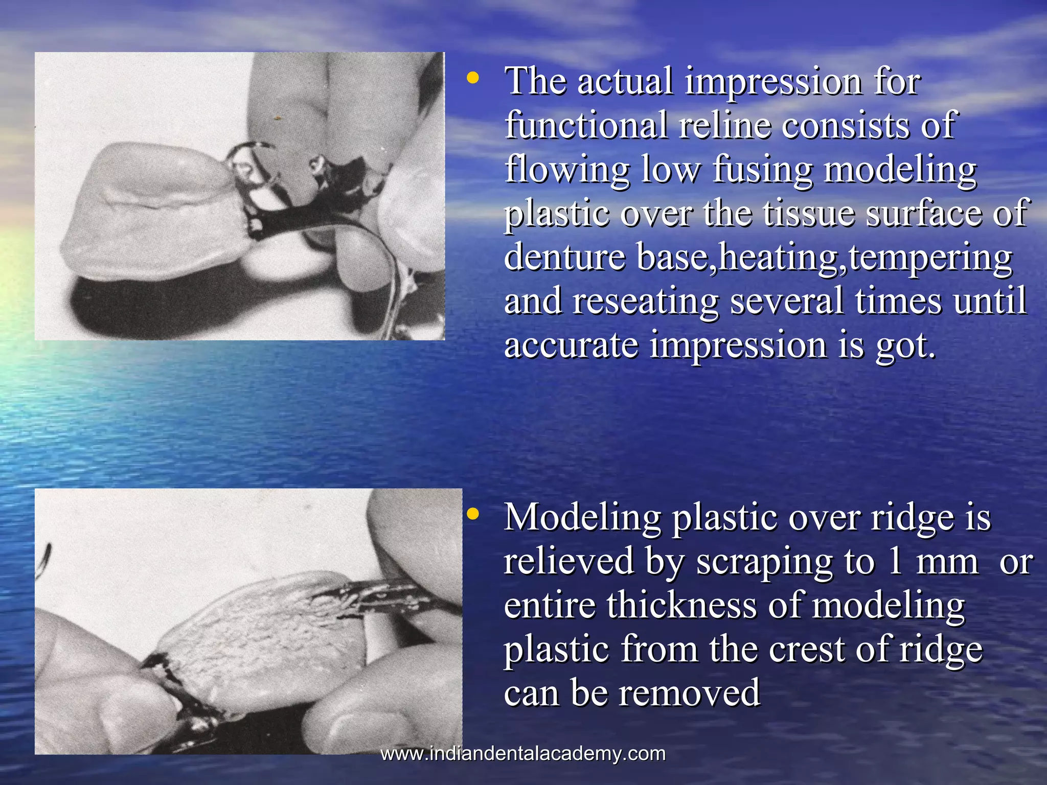 • The actual impression forThe actual impression for
functional reline consists offunctional reline consists of
flowing low fusing modelingflowing low fusing modeling
plastic over the tissue surface ofplastic over the tissue surface of
denture base,heating,temperingdenture base,heating,tempering
and reseating several times untiland reseating several times until
accurate impression is got.accurate impression is got.
• Modeling plastic over ridge isModeling plastic over ridge is
relieved by scraping to 1 mm orrelieved by scraping to 1 mm or
entire thickness of modelingentire thickness of modeling
plastic from the crest of ridgeplastic from the crest of ridge
can be removedcan be removed
www.indiandentalacademy.comwww.indiandentalacademy.com
 