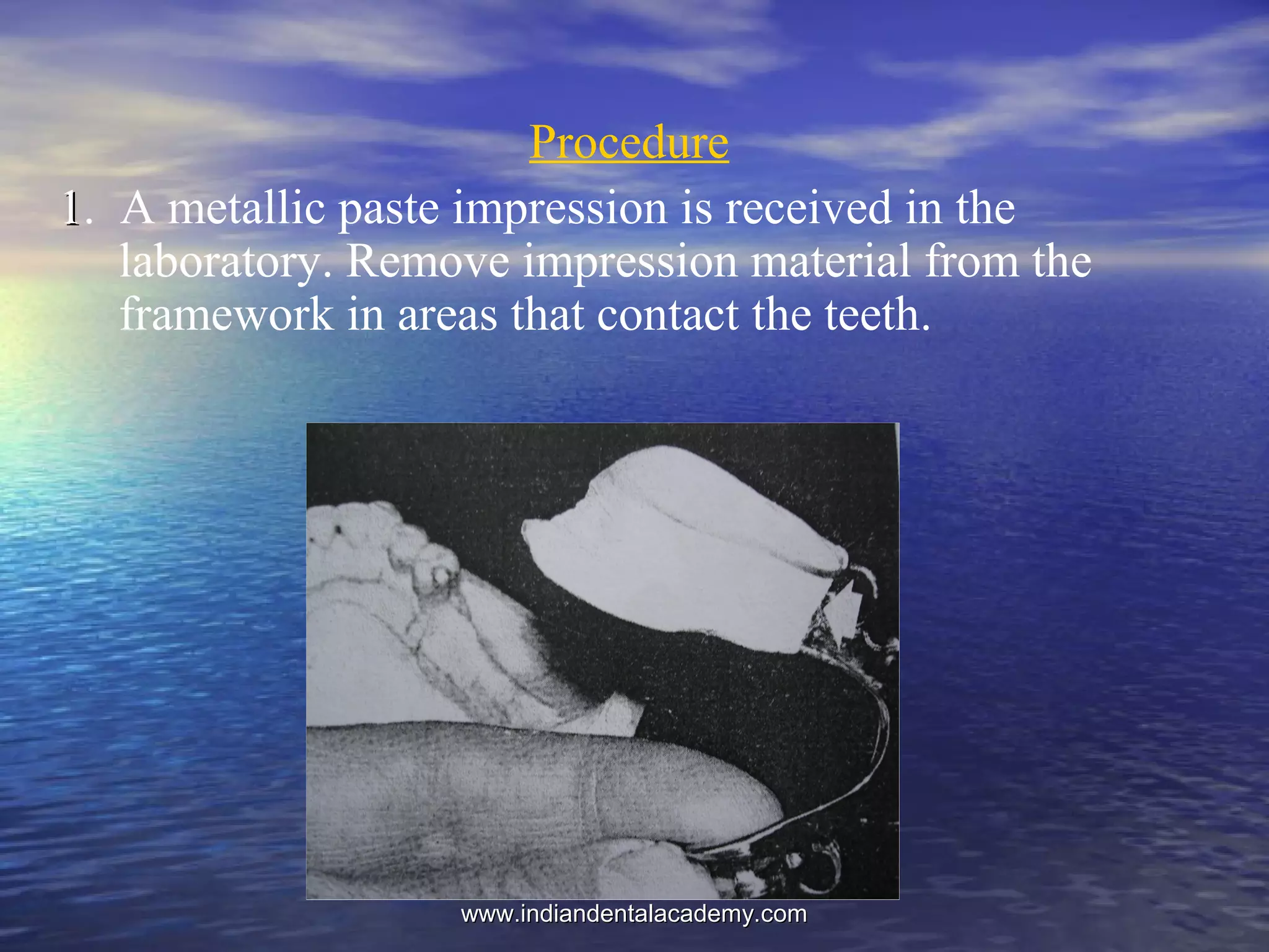 Procedure
11. A metallic paste impression is received in the
laboratory. Remove impression material from the
framework in areas that contact the teeth.
www.indiandentalacademy.comwww.indiandentalacademy.com
 