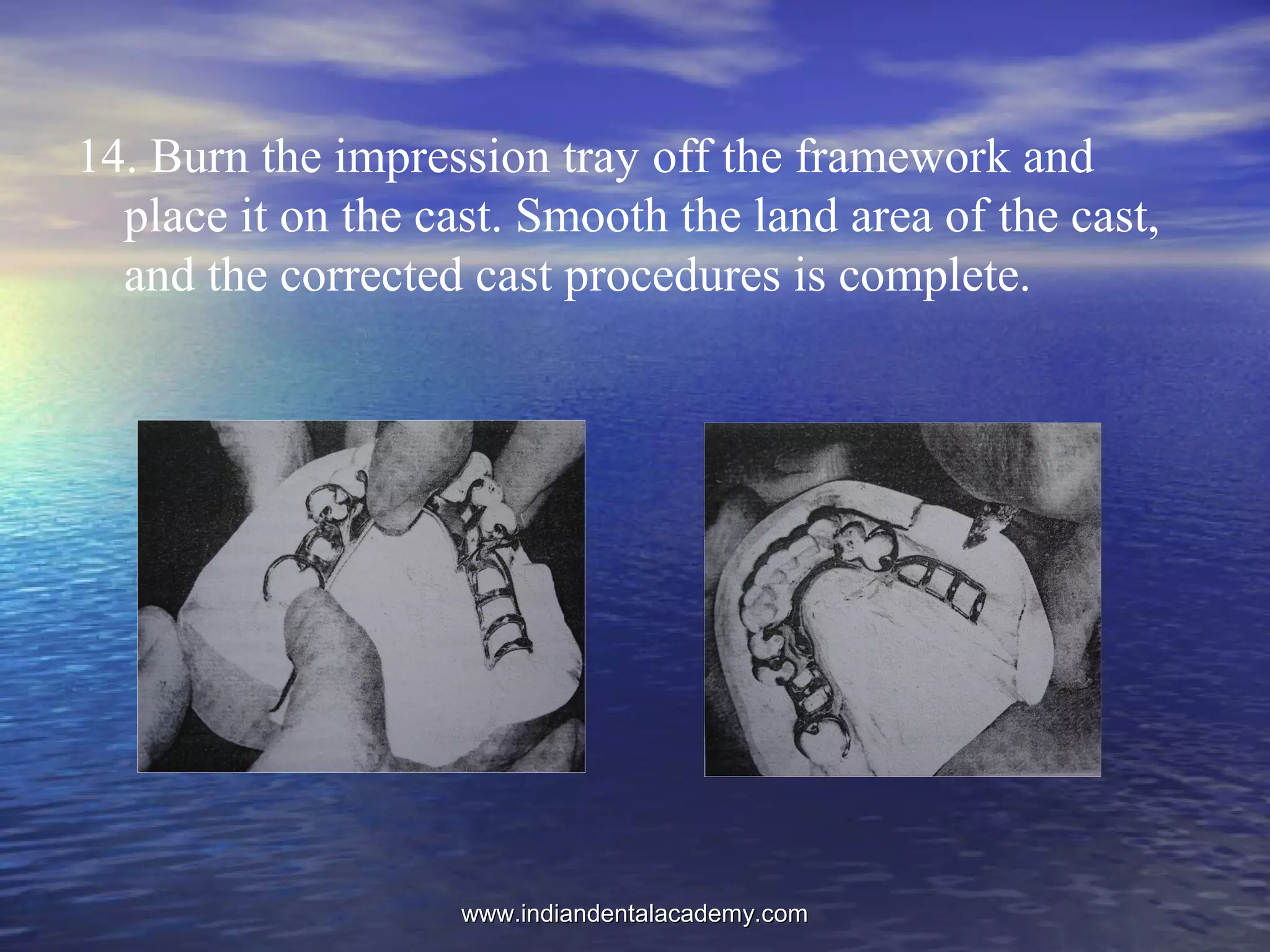 14. Burn the impression tray off the framework and
place it on the cast. Smooth the land area of the cast,
and the corrected cast procedures is complete.
www.indiandentalacademy.comwww.indiandentalacademy.com
 