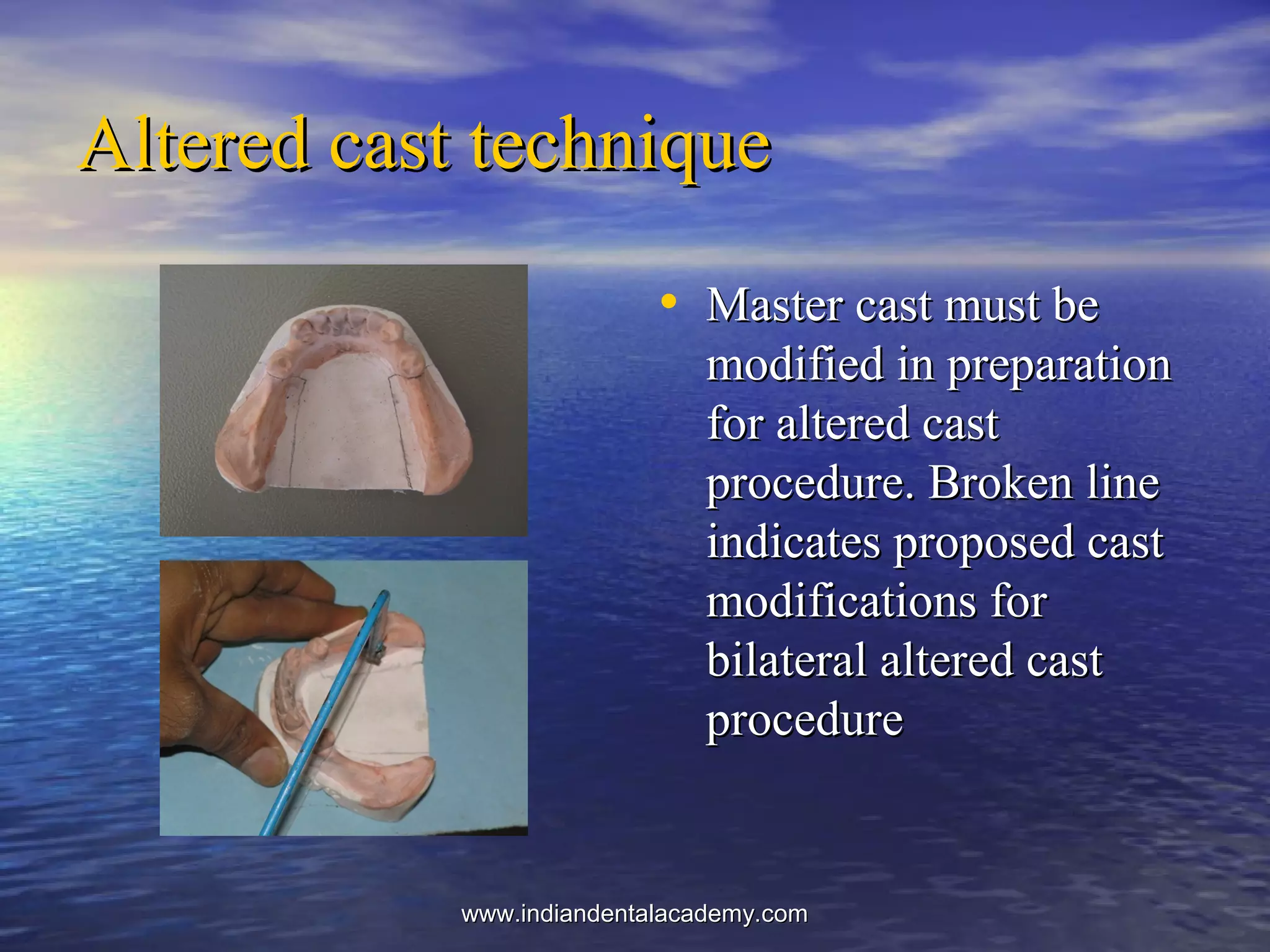 Altered cast techniqueAltered cast technique
• Master cast must beMaster cast must be
modified in preparationmodified in preparation
for altered castfor altered cast
procedure. Broken lineprocedure. Broken line
indicates proposed castindicates proposed cast
modifications formodifications for
bilateral altered castbilateral altered cast
procedureprocedure
www.indiandentalacademy.comwww.indiandentalacademy.com
 
