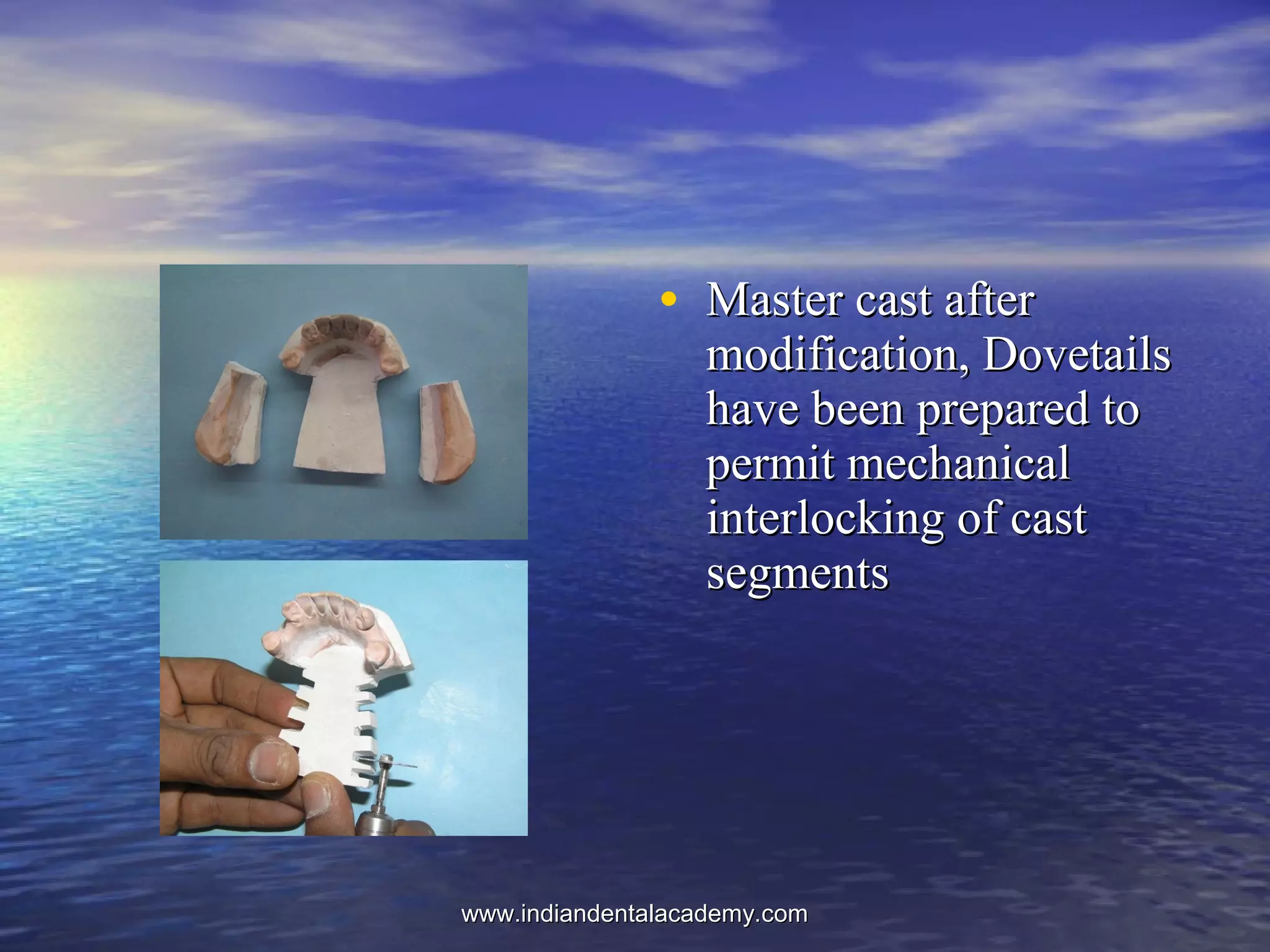 • Master cast afterMaster cast after
modification, Dovetailsmodification, Dovetails
have been prepared tohave been prepared to
permit mechanicalpermit mechanical
interlocking of castinterlocking of cast
segmentssegments
www.indiandentalacademy.comwww.indiandentalacademy.com
 