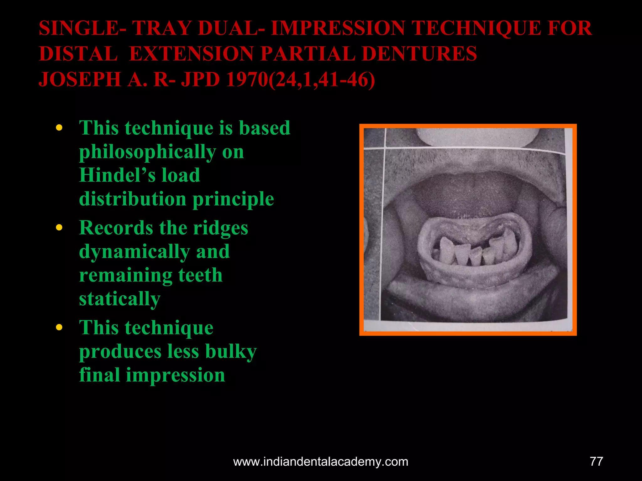 Impression techniques for rpd / dental crown & bridge courses