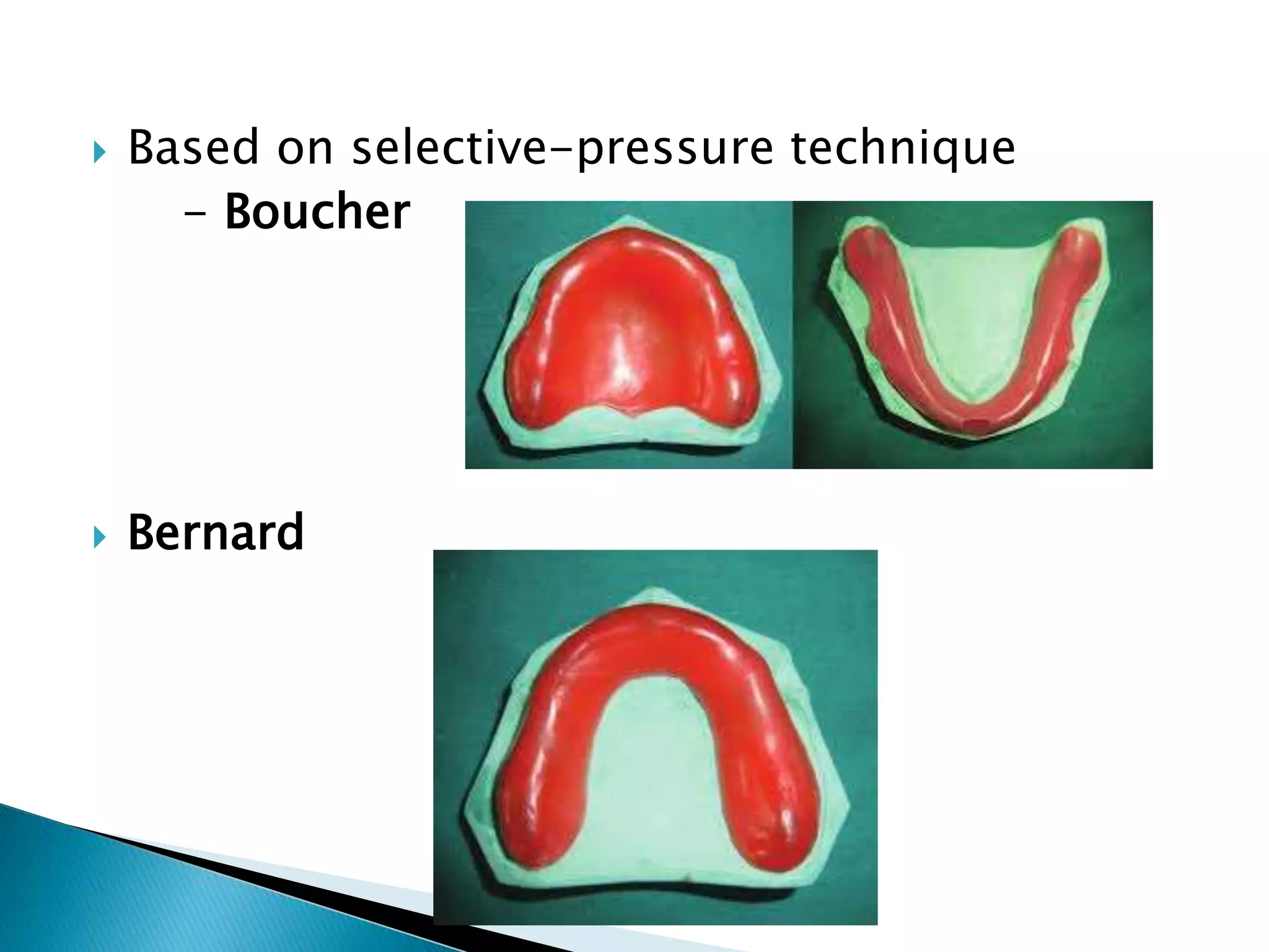  Based on selective-pressure technique
- Boucher
 Bernard
 