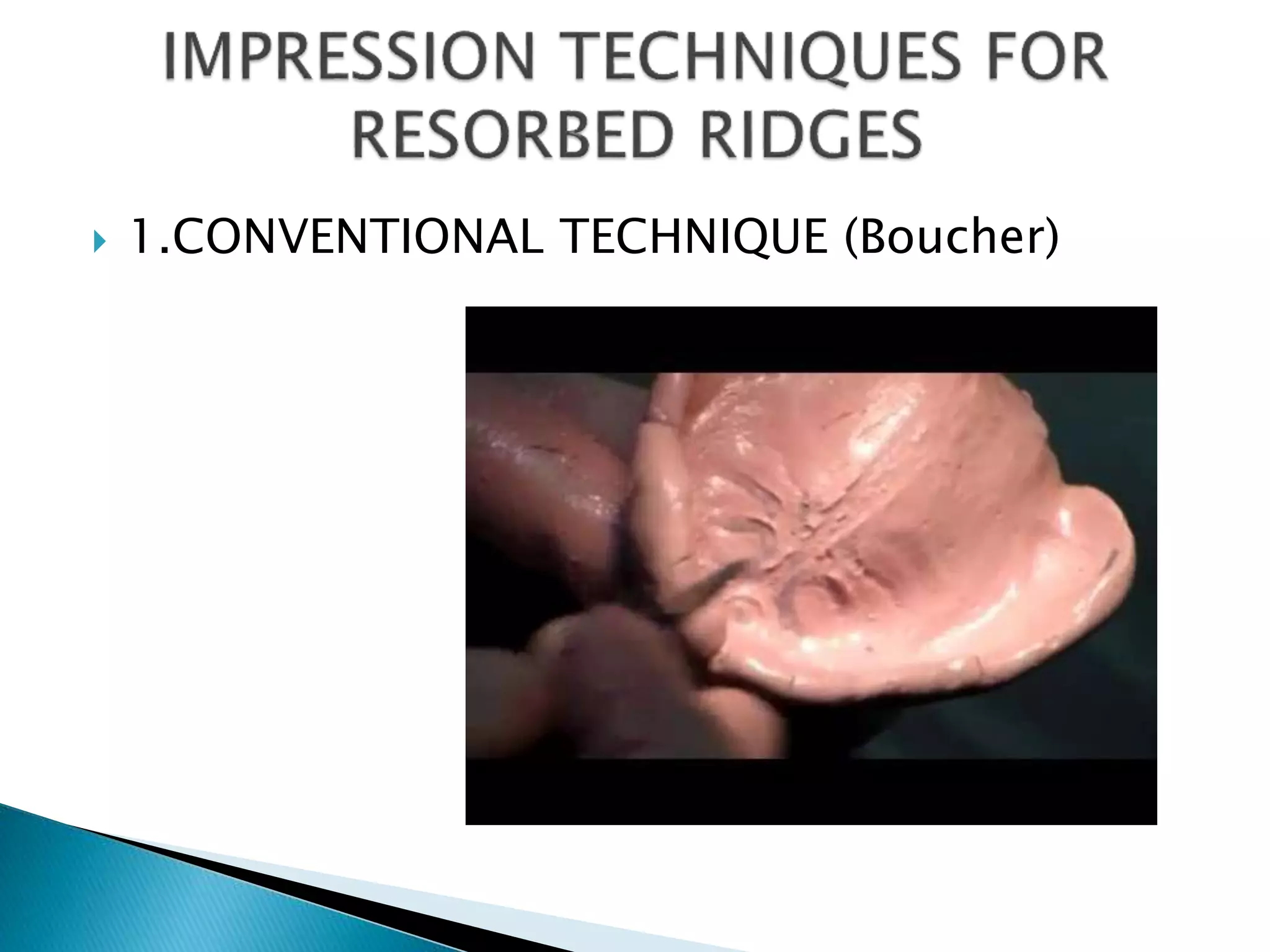  1.CONVENTIONAL TECHNIQUE (Boucher)
 