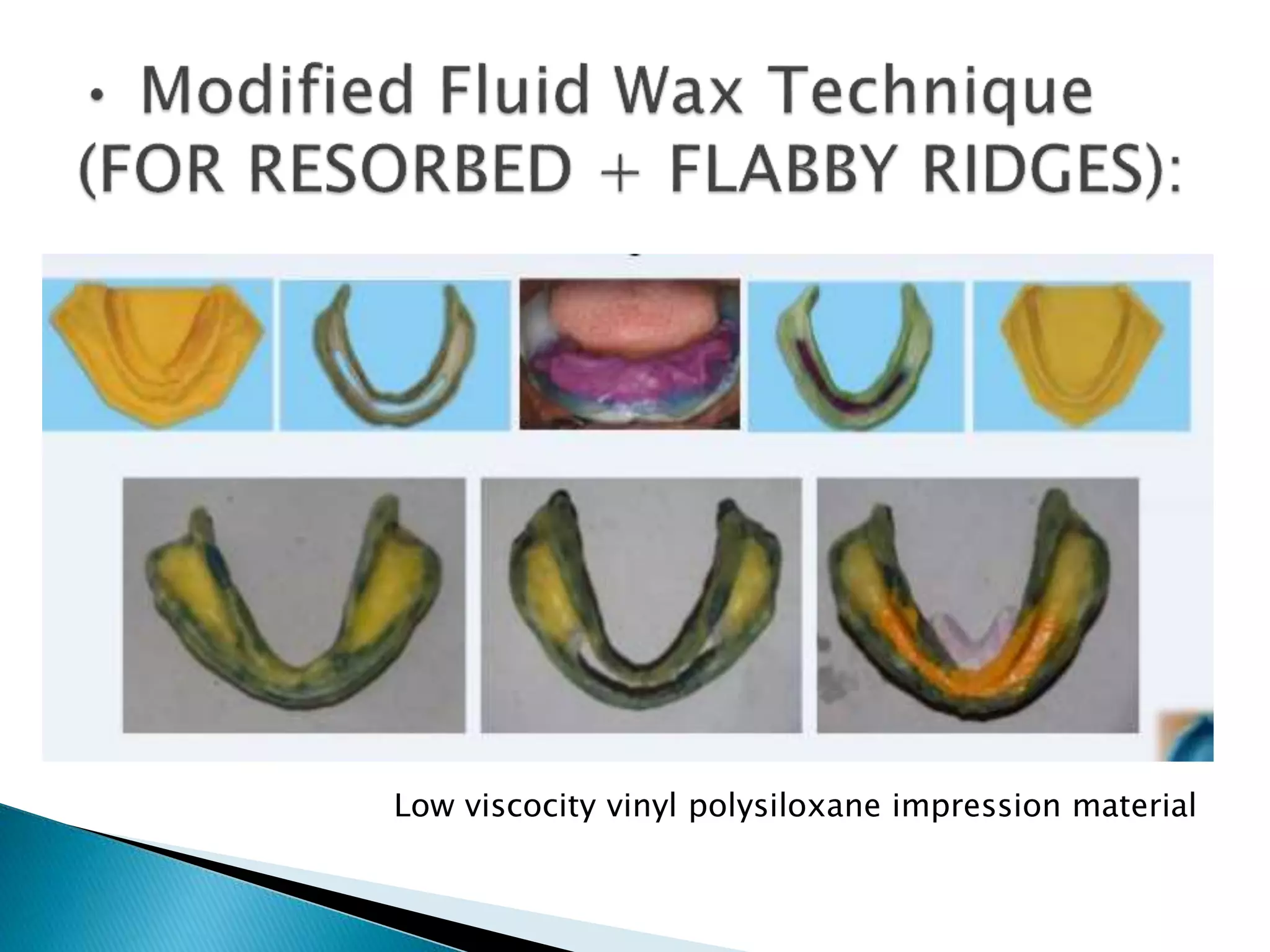 Low viscocity vinyl polysiloxane impression material
 