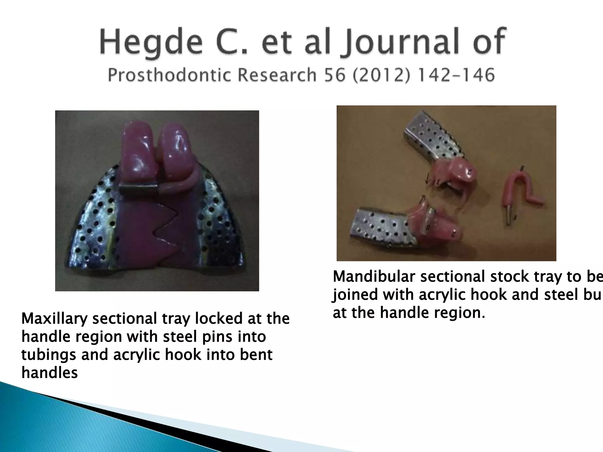 Maxillary sectional tray locked at the
handle region with steel pins into
tubings and acrylic hook into bent
handles
Mandibular sectional stock tray to be
joined with acrylic hook and steel bur
at the handle region.
 