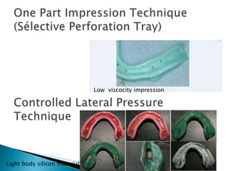Light body silicon material
Low viscocity impression
 