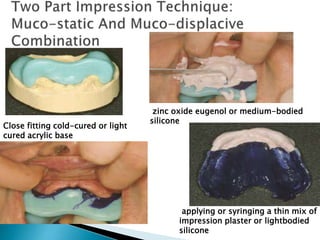 Close fitting cold-cured or light
cured acrylic base
applying or syringing a thin mix of
impression plaster or lightbodied
silicone
zinc oxide eugenol or medium-bodied
silicone
 