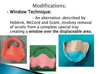  Window Technique:
– An alternative, described by
Hobkirk, McCord and Grant, involves removal
of acrylic from a complete special tray
creating a window over the displaceable area.
 