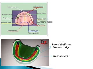 ALVEOLAR RIDGE
buccal shelf area
Posterior ridge
anterior ridge
 