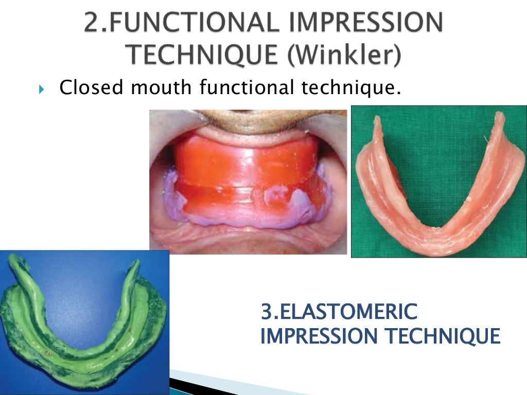 Impression techniques in complete denture