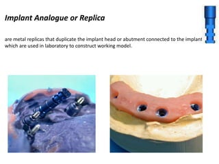 Implant Analogue or Replica
are metal replicas that duplicate the implant head or abutment connected to the implant
which are used in laboratory to construct working model.
 