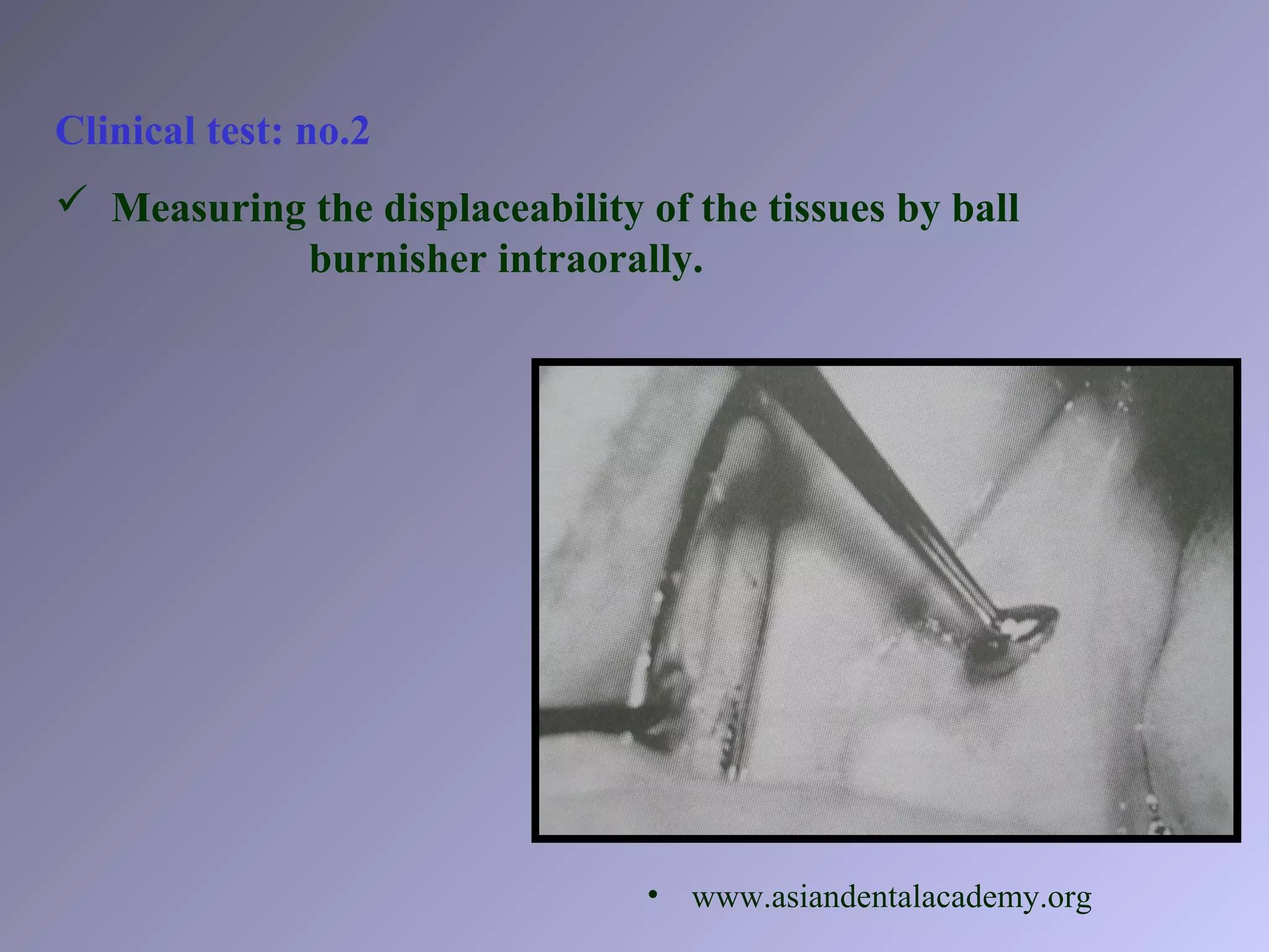 Clinical test: no.2
 Measuring the displaceability of the tissues by ball
burnisher intraorally.
• www.asiandentalacademy.org
 