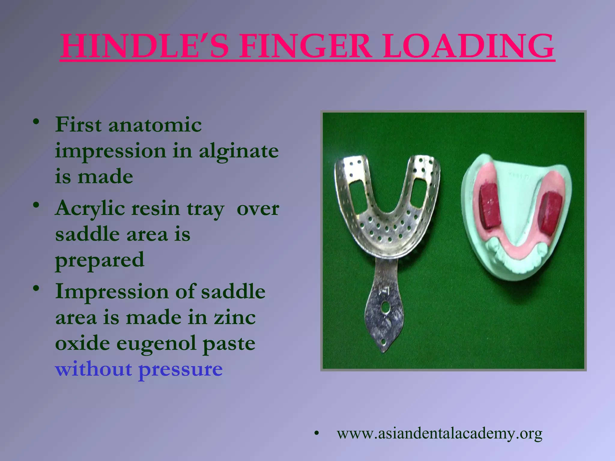HINDLE’S FINGER LOADING
• First anatomic
impression in alginate
is made
• Acrylic resin tray over
saddle area is
prepared
• Impression of saddle
area is made in zinc
oxide eugenol paste
without pressure
• www.asiandentalacademy.org
 