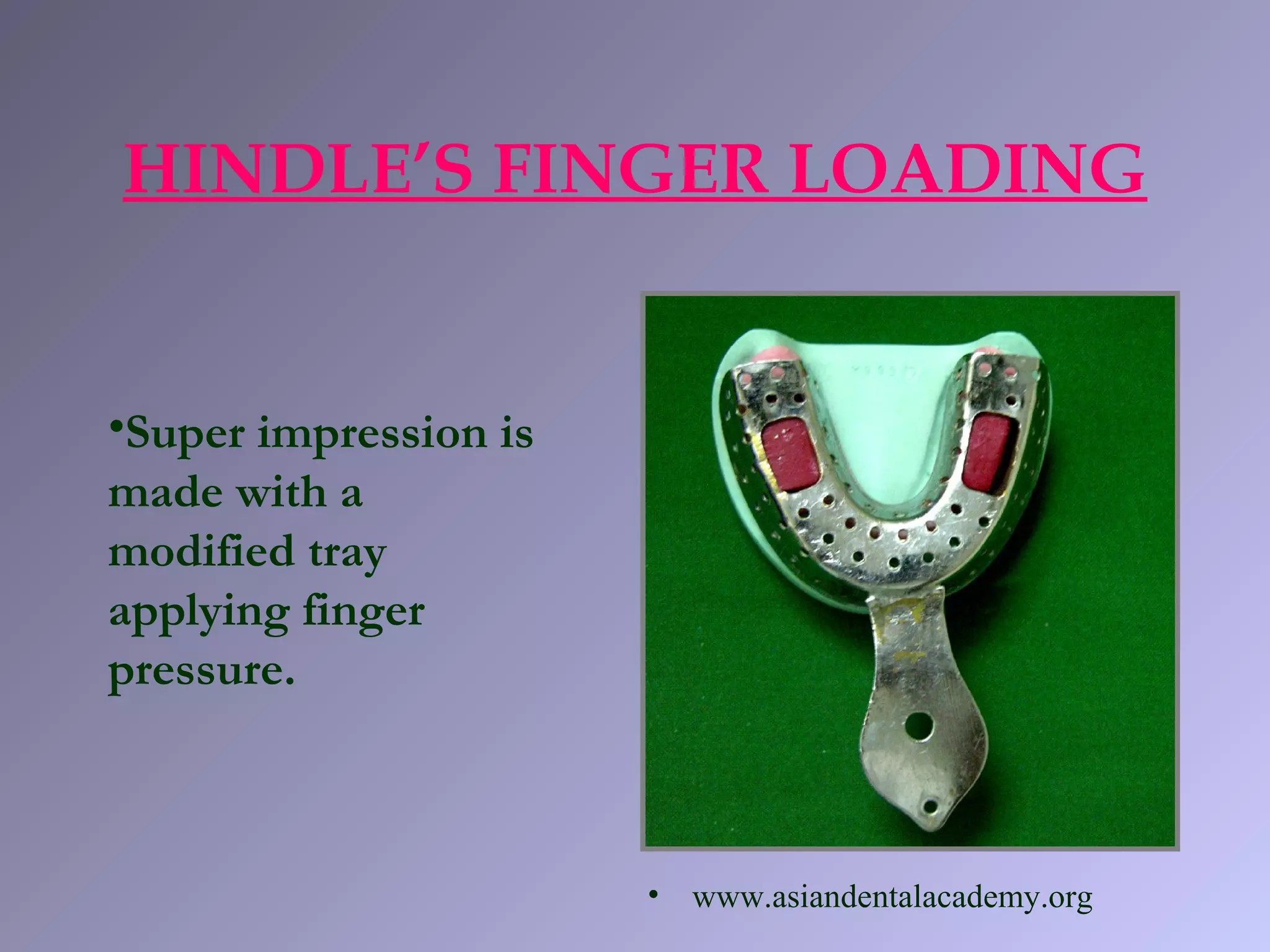 HINDLE’S FINGER LOADING
•Super impression is
made with a
modified tray
applying finger
pressure.
• www.asiandentalacademy.org
 