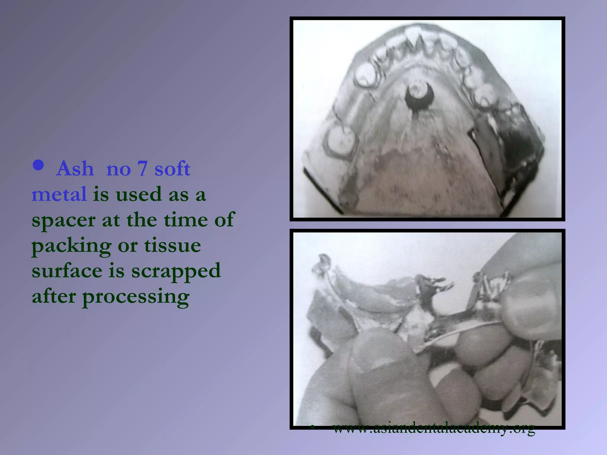  Ash no 7 soft
metal is used as a
spacer at the time of
packing or tissue
surface is scrapped
after processing
• www.asiandentalacademy.org
 
