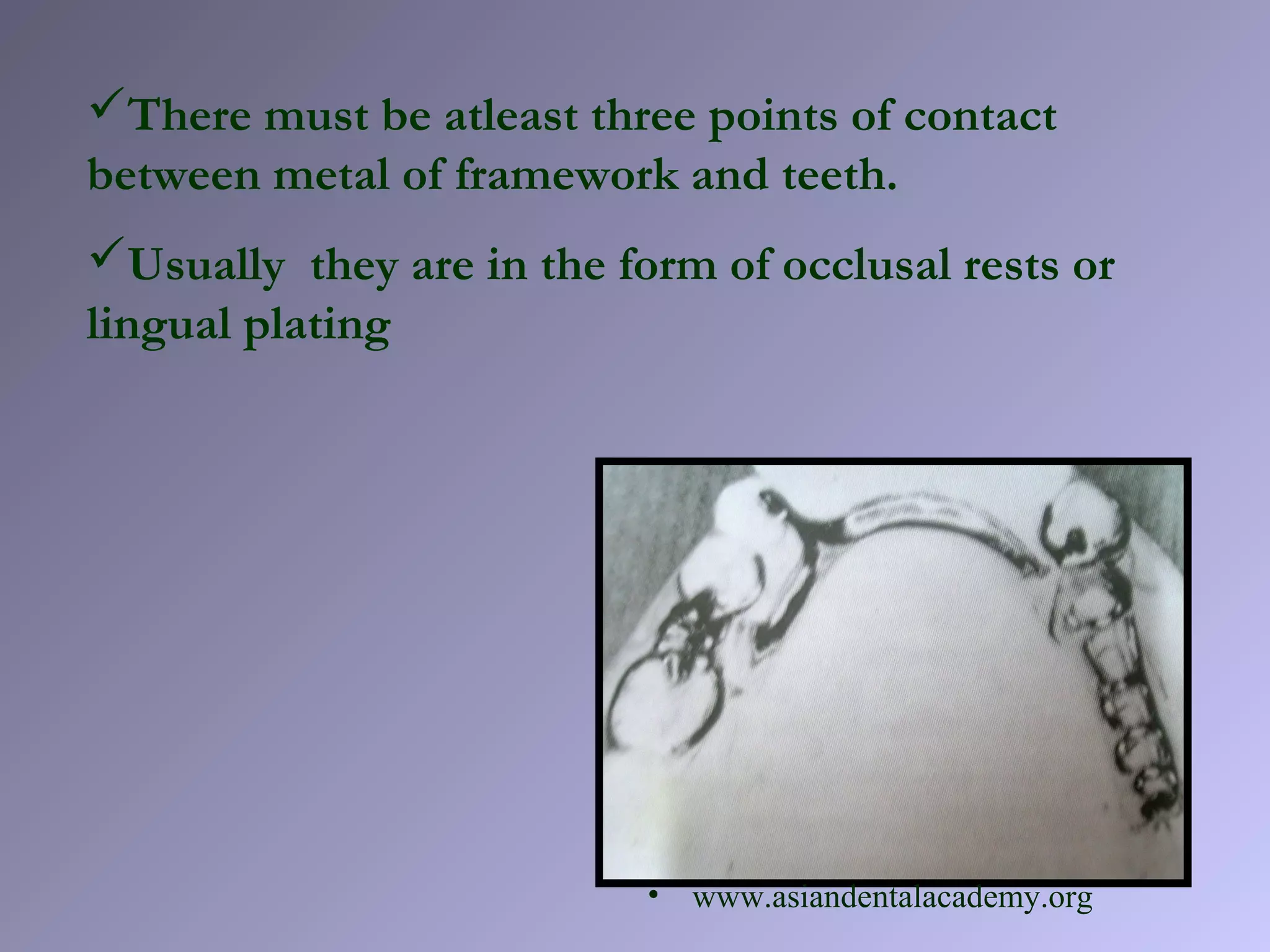 There must be atleast three points of contact
between metal of framework and teeth.
Usually they are in the form of occlusal rests or
lingual plating
• www.asiandentalacademy.org
 