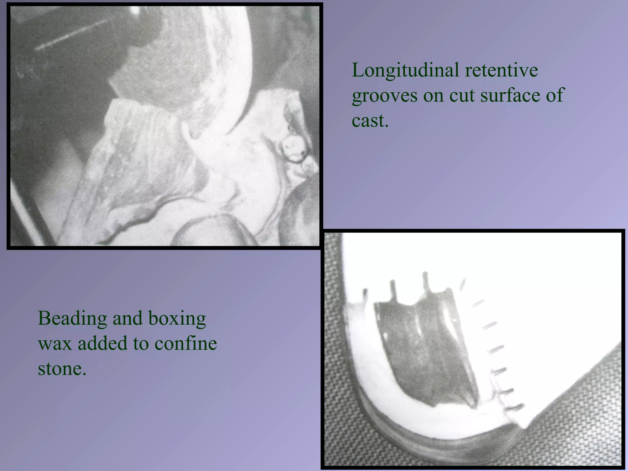 Longitudinal retentive
grooves on cut surface of
cast.
Beading and boxing
wax added to confine
stone.
 