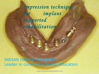 Impression technique
for implant
supported
rehabilitation
INDIAN DENTAL ACADEMY
Leader in continuing Dental Education
www.indiandentalacademy.comwww.indiandentalacademy.com
 