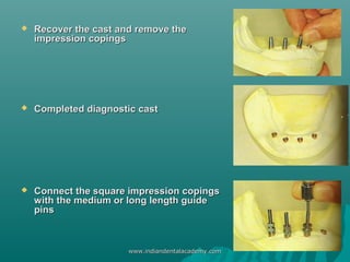  Recover the cast and remove theRecover the cast and remove the
impression copingsimpression copings
 Completed diagnost...