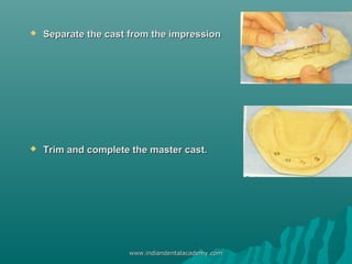  Separate the cast from the impressionSeparate the cast from the impression
 Trim and complete the master cast.Trim and ...