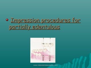 Impression procedures forImpression procedures for
partially edentulouspartially edentulous
www.indiandentalacademy.comwww...