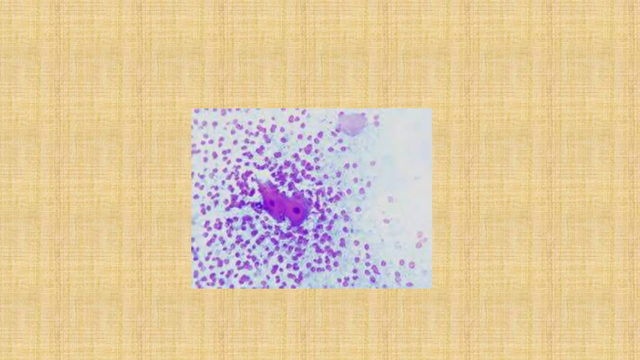 Imprint cytology | PPTX