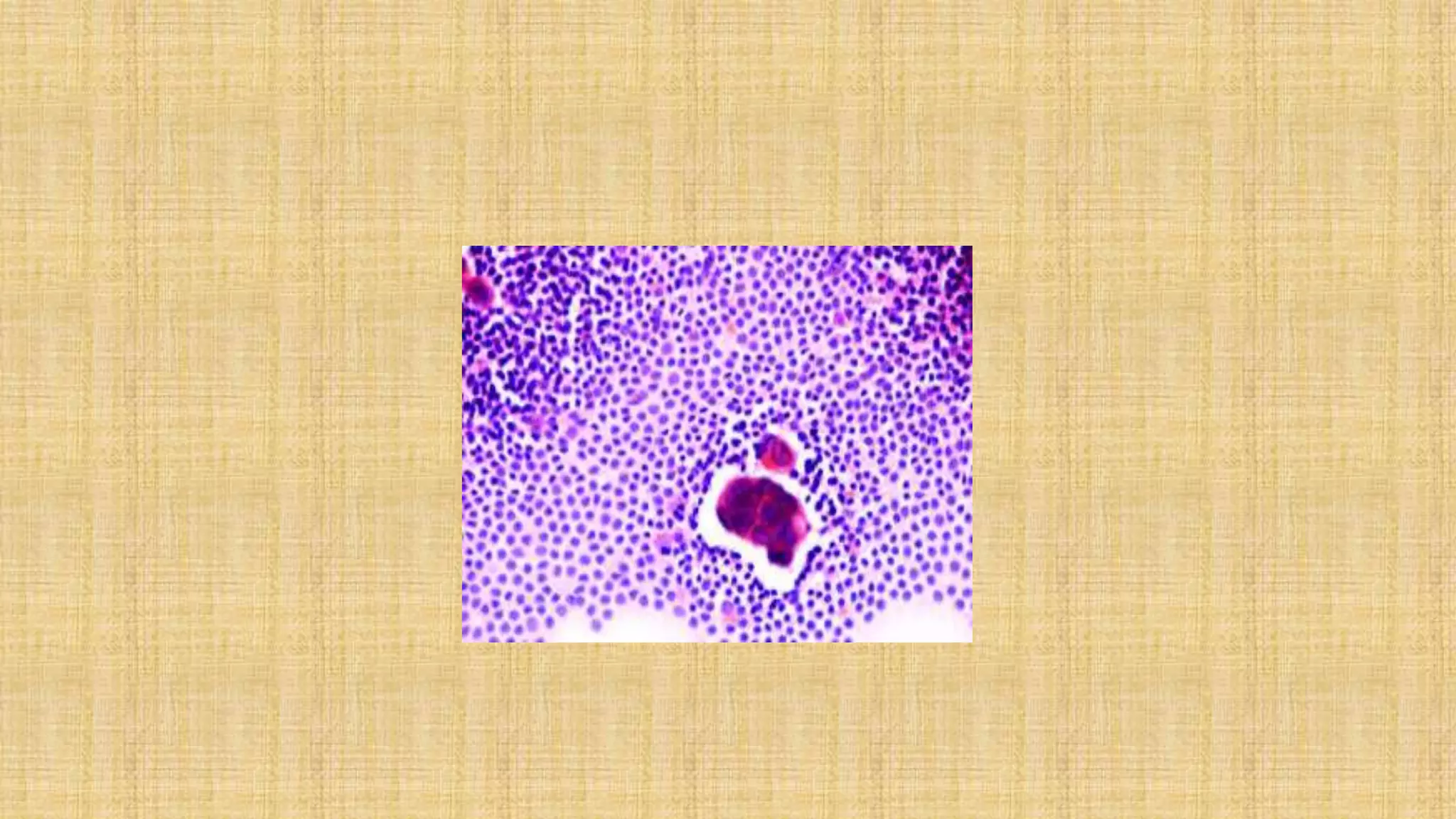Imprint cytology | PPTX