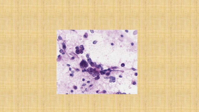 Imprint cytology | PPTX | Thyroid Disorders | Endocrine and Metabolic ...
