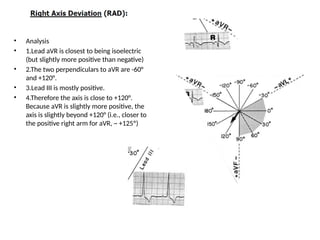 • Analysis
• 1.Lead aVR is closest to being isoelectric
(but slightly more positive than negative)
• 2.The two perpendiculars to aVR are -60°
and +120°.
• 3.Lead III is mostly positive.
• 4.Therefore the axis is close to +120°.
Because aVR is slightly more positive, the
axis is slightly beyond +120° (i.e., closer to
the positive right arm for aVR, ~ +125º)
 